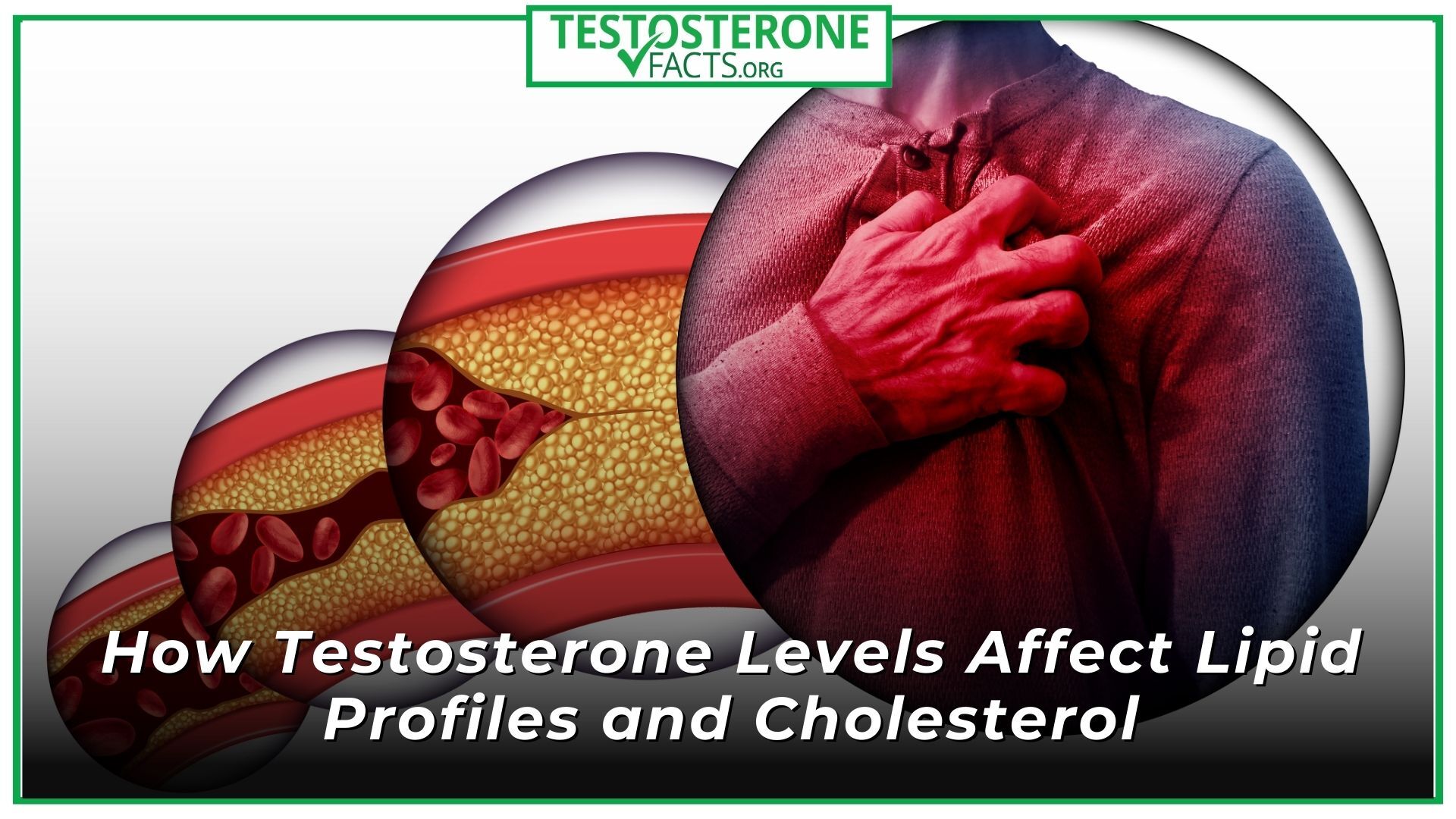 How Testosterone Levels Affect Lipid Profiles and Cholesterol